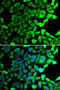Ubiquitin Specific Peptidase 8 antibody, STJ29111, St John