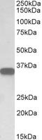 CD20 antibody, LS-B11144, Lifespan Biosciences, Western Blot image 