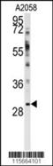 WW Domain Binding Protein 2 antibody, 63-202, ProSci, Western Blot image 