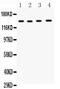 Matrix Metallopeptidase 14 antibody, PA2147, Boster Biological Technology, Western Blot image 