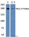 TSC Complex Subunit 2 antibody, A00229T1462-1, Boster Biological Technology, Western Blot image 