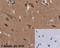 Glucose-6-Phosphate Isomerase antibody, ab66340, Abcam, Immunohistochemistry paraffin image 