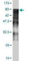 Zinc Finger And SCAN Domain Containing 20 antibody, H00007579-M02, Novus Biologicals, Western Blot image 