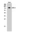 Leucine Rich Repeat Containing 41 antibody, A13640-1, Boster Biological Technology, Western Blot image 