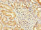 Tissue Specific Transplantation Antigen P35B antibody, LS-C211694, Lifespan Biosciences, Immunohistochemistry paraffin image 
