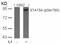 Signal Transducer And Activator Of Transcription 5A antibody, 79-126, ProSci, Western Blot image 