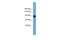 Apoptosis Resistant E3 Ubiquitin Protein Ligase 1 antibody, ARP44874_P050, Aviva Systems Biology, Western Blot image 