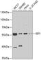 Eukaryotic Translation Initiation Factor 5 antibody, GTX33176, GeneTex, Western Blot image 