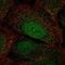 Homeobox A2 antibody, NBP2-58865, Novus Biologicals, Immunofluorescence image 