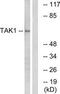 Mitogen-Activated Protein Kinase Kinase Kinase 7 antibody, TA326198, Origene, Western Blot image 