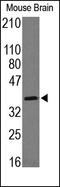 Melatonin Receptor 1A antibody, 250761, Abbiotec, Western Blot image 