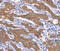 Serum/Glucocorticoid Regulated Kinase 2 antibody, MBS2519978, MyBioSource, Immunohistochemistry frozen image 