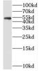 Endosome Associated Trafficking Regulator 1 antibody, FNab07665, FineTest, Western Blot image 