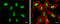 DNA Methyltransferase 3 Beta antibody, GTX129127, GeneTex, Immunocytochemistry image 