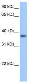 Nex1 antibody, TA330530, Origene, Western Blot image 