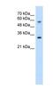 Solute Carrier Family 22 Member 1 antibody, NBP1-59419, Novus Biologicals, Western Blot image 