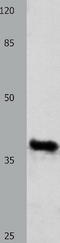 MIC-1 antibody, TA321673, Origene, Western Blot image 