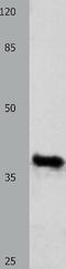 GDF-15 antibody, TA321673, Origene, Western Blot image 