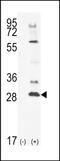 Testis Specific Serine Kinase 4 antibody, PA5-71502, Invitrogen Antibodies, Western Blot image 
