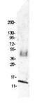 C-C Motif Chemokine Ligand 4 antibody, GTX48752, GeneTex, Western Blot image 