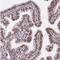 CREB Binding Protein antibody, NBP2-38774, Novus Biologicals, Immunohistochemistry paraffin image 