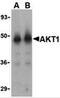Protein kinase B antibody, 3519, ProSci Inc, Western Blot image 
