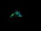 Ubiquitin Conjugating Enzyme E2 G2 antibody, M07427-1, Boster Biological Technology, Immunofluorescence image 
