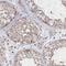 Nucleoporin 155 antibody, NBP1-82960, Novus Biologicals, Immunohistochemistry paraffin image 