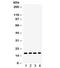 Centromere Protein A antibody, R32115, NSJ Bioreagents, Western Blot image 