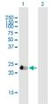 Vasohibin 1 antibody, H00022846-B01P, Novus Biologicals, Western Blot image 