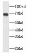 Mitogen-Activated Protein Kinase 4 antibody, FNab04992, FineTest, Western Blot image 