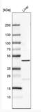 PR/SET Domain 12 antibody, NBP1-85829, Novus Biologicals, Western Blot image 