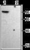 Potassium Voltage-Gated Channel Subfamily A Member 4 antibody, GTX54836, GeneTex, Western Blot image 