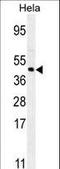 Forkhead Box L2 antibody, LS-C166233, Lifespan Biosciences, Western Blot image 
