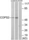COP9 Signalosome Subunit 2 antibody, LS-C118959, Lifespan Biosciences, Western Blot image 