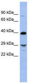 Oligodendrocyte Transcription Factor 3 antibody, TA345605, Origene, Western Blot image 