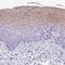 Mucin 21, Cell Surface Associated antibody, NBP2-31023, Novus Biologicals, Immunohistochemistry frozen image 