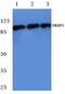 Endoplasmic Reticulum Aminopeptidase 1 antibody, PA5-36218, Invitrogen Antibodies, Western Blot image 