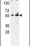 Glucose-6-Phosphate Dehydrogenase antibody, PA5-25017, Invitrogen Antibodies, Western Blot image 