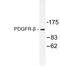 Platelet Derived Growth Factor Receptor Beta antibody, LS-C176612, Lifespan Biosciences, Western Blot image 