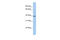 Serine Protease 54 antibody, 26-886, ProSci, Enzyme Linked Immunosorbent Assay image 