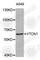 V-Set Domain Containing T Cell Activation Inhibitor 1 antibody, A8786, ABclonal Technology, Western Blot image 