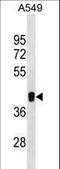 Makorin Ring Finger Protein 1 antibody, LS-C157888, Lifespan Biosciences, Western Blot image 