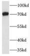 TNF Receptor Associated Factor 7 antibody, FNab08922, FineTest, Western Blot image 