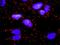 CD247 Molecule antibody, H00000919-D01P, Novus Biologicals, Proximity Ligation Assay image 