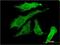 RNA-binding protein with multiple splicing antibody, H00011030-M03, Novus Biologicals, Immunocytochemistry image 