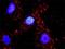 Actin Gamma 1 antibody, H00000071-M01, Novus Biologicals, Western Blot image 