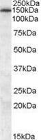 ATP Binding Cassette Subfamily C Member 5 antibody, GTX88691, GeneTex, Western Blot image 