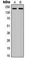 Colony Stimulating Factor 1 Receptor antibody, abx121564, Abbexa, Western Blot image 