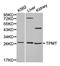 Thiopurine S-Methyltransferase antibody, orb129756, Biorbyt, Western Blot image 